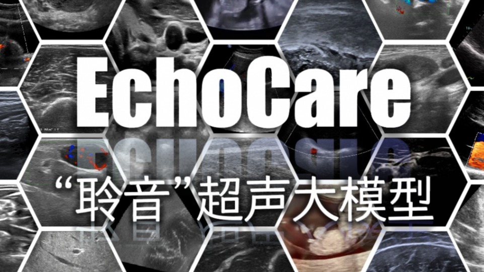 引领超声影像AI革命，EchoCare“聆音”超声大模型正式开源